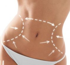 LIPOESCULTURA