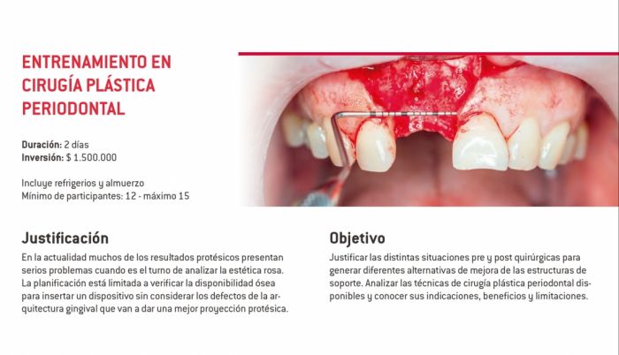 Entrenamiento en cirugía plástica periodontal